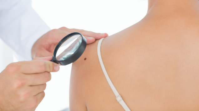 Skin Cancer Clinic Townsville
