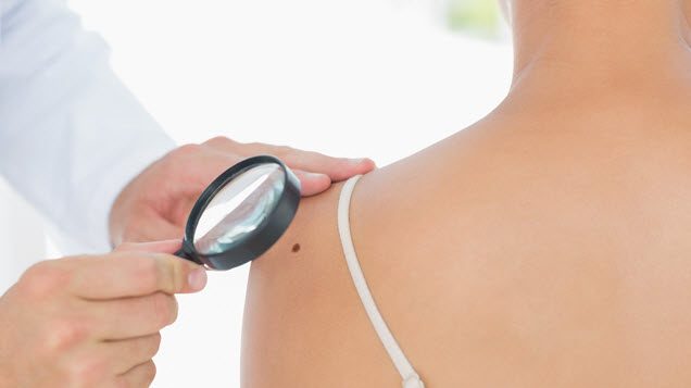 How can you check for skin cancer